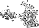 A, Liver cells. B, Liver cells, containing various sized particles of fat.