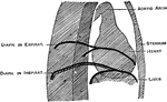 Orthodiagram of the thorax. The position of parts is shown in extreme inspiration; the position of the diaphragm and liver in expiration is also shown.