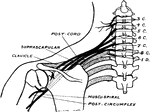 Upper and middle trunks of the brachial plexus viewed from behind to show how depression of the shoulder or lateral abduction of the head may produce stretching and injury of the nerve cords.