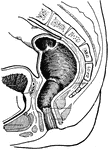 The stages of the rectum and the anal canal on mesial section.