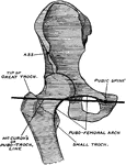 Diagram showing that the pubic spine (tubercle) and the tip of the great trochanter are on the same horizontal plane (McCurdy's line), and that the lower border of the neck of the femur and the inner border of the obturator foramen form a continuos arch (Shenton's) when the femur has its normal relationships.