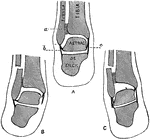 Transverse section through the lower third of the leg. Labels: a, tibialis anticus; b, extensor longus hallucis; c, extensor communis digitorum; d, peroneus brevis; e, peroneus longus; t, tibialis posticus; g, flexor longus digitorum; h, flexor longus hallucis; i, gastrocnemius and soleus; j, short saphenous nerve and vein; k, anterior tibial vessels and nerve; l, peroneal vessels; m, posterior tibial vessels and nerve; n, musculo-cutaneous nerve.