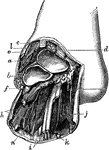 Chopart's operation is is an amputation at the mediotarsal joint. Labels: a, astragalus; b, os calcis; c, extensor proprius hallucis; d, tibialis anticus; e, extensor communis digitorum; f, peroneus longus; g, adductor minimi digiti; h, flexor brevis digitorum; i, flexor longus digitorum; j, abductor hallucis; k, flexor longus hallucis; l, dorsalis pedis artery; m, internal plantar artery; n, external plantar artery.