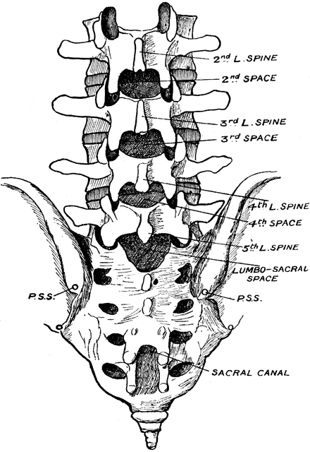 Lumbar Showing Position of Fourth Lumbar Spine | ClipArt ETC