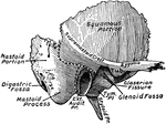 The outer surface of the temporal bone. The dotted lines indicate the lines of suture between squamous, mastoid, or tympanic portions.