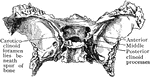 Sphenoid bone, showing abnormal development of middle clinoid processes, especially on the left side.