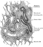 Section of deeper coiled portion of sweat gland.