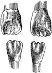 Unworn surfaces of upper and lower permanent incisor teeth, lingual aspect.