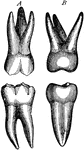 Second molar teeth to the left side, labial (A) and lateral (B) aspects.
