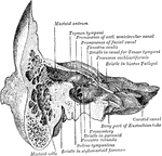 Section through the petrous and mastoid portions of the temporal bone, showing the communication of the cavity of the tympanum with the mastoid antrum.