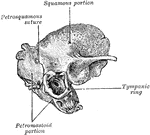 Temporal bone at birth. Outer aspect.