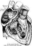 The right auricle and ventricle laid open, the anterior walls of both being removed.