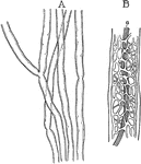 A, Myelinic axons in fresh state, showing few nodes. B, Portion of a myelinic axon treated with boiling ether and alcohol to remove the myelin and leaving the neurokeratin network. a, axon.