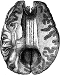 Shown is the corpus callosum. The corpus callosum is a thick stratum of transversely directed nerve fibers, by which almost every part of one cerebral hemisphere is connected with the corresponding part of the other cerebral hemisphere.