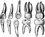 Lingual view of temporary teeth.