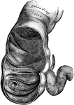 The cecum and colon laid open to show the ileocecal valve.