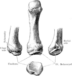 Fifth metacarpal bone.