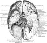 The base of the brain. The under part of the left temporal and occipital lobes has been sliced off so as to open into the lateral ventricle. The left hemisphere of the cerebellum has also been removed.