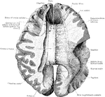 The corpus callosum, exposed from above and the right half dissected to show the course taken by its fibers.