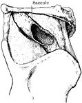 Specimen showing a great extension of the saccule of the larynx.