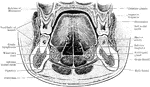 Coronal section through the closed mouth. The slit liked character of the vestibule, the manner which the tongue fills up the mouth cavity, the close apposition of the teeth, the relations of the roots of the upper molars to the antrum of Highmore, the plica sublingualis over the sublingual gland, and the position of the ranine artery should be noted.