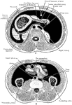 Diagrammatic transverse section of abdomen, to show the peritoneum on transverse tracing. A, at level of foramen of Winslow. B, lower down. In A note, one of the vasa brevia arteris passing to the stomach between the layers of the gastrosplenic omentum, and also the foramen of Winslow leading into the lesser sac which lies behind the stomach.