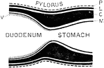 Diagram to show formation of pylorus. Labels: P, peritoneum; L, longitudinal layer of muscular fibers; C, circular layer; M, mucous membrane; V, villi. It will be seen that the pyloric narrowing is due practically entirely to a gradual thickening of the circular muscular fibers, which stops abruptly at the pyloric orifice.