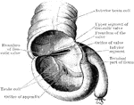 Caecum showing ileocaecal valve. The caecum bas been distended with air and dried, and a portion of its anterior wall has been removed.