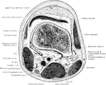 Section through thigh immediately above the patella.