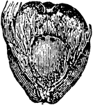 An illustration of a cocoanut's husk open showing the hard endocarp. Although coconut meat contains less fat than other dry nuts such as almonds, it is noted for its high amount of saturated fat.Approximately 90% of the fat found in coconut meat is saturated, a proportion exceeding that of foods such as lard, butter, and tallow. However, there has been some debate as to whether or not the saturated fat in coconuts is healthier than the saturated fat found in other foods. Coconut meat also contains less sugar and more protein than popular fruits such as bananas, apples and oranges, and it is relatively high in minerals such as iron, phosphorus and zinc.