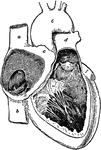 Cavities of the right side of the heart.
