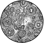 Thin section of Jurassic oolite showing the characteristic zonal structure.