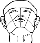 This is a male face shown with a bald head. The head is tilted backwards.