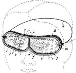 Safety glasses are usually made with shatter-resistant plastic lenses to protect the eye from flying debris. Although safety lenses may be constructed from a variety of materials of various impact resistance, certain standards suggest that they maintain a minimum 1 millimeter thickness at the thinnest point, regardless of material. Safety glasses can vary in the level of protection they provide.