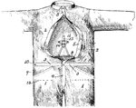This Union overcall garment was used as a suit which is still commercially available. Depending on the size, some union suits can have a dozen buttons on the front to be fastened through buttonholes from the neck down to the groin area.