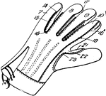 A garment covering the hand. Gloves have separate sheaths or openings for each finger and the thumb; if there is an opening but no covering sheath for each finger they are called "fingerless gloves".