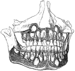 Jaw showing the temporary and permanent teeth.