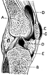 This illustration shows a section on the knee (A, Femur; B, Tibia; C, Patella; D, Synovial sac; E, bursæ). The knee is a hinge-joint, and the bones entering into its formation are the lower end of the femur, the upper end of the tibia, and the posterior surface of the patella (knee-cap).